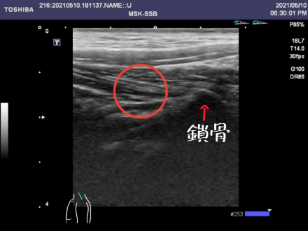 echo image 1