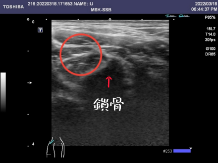 echo image 2