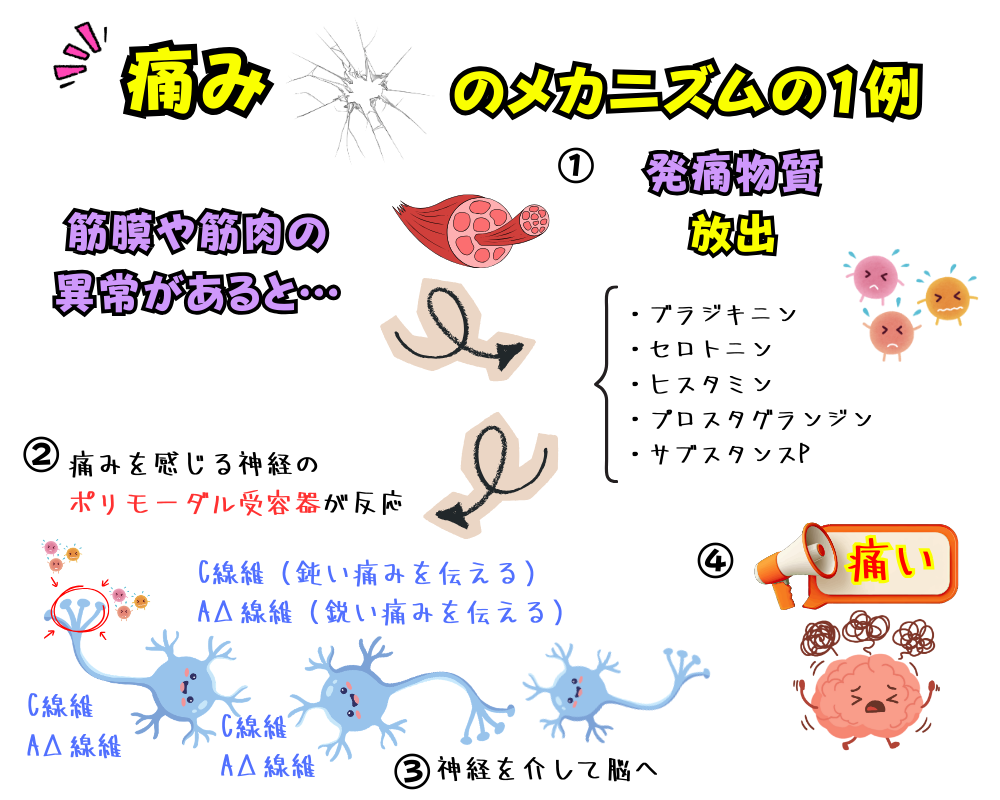 痛みが出るメカニズム図