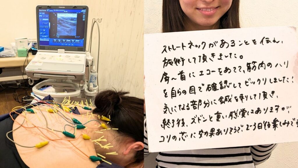 肩こり鍼灸　肩こりエコー画像